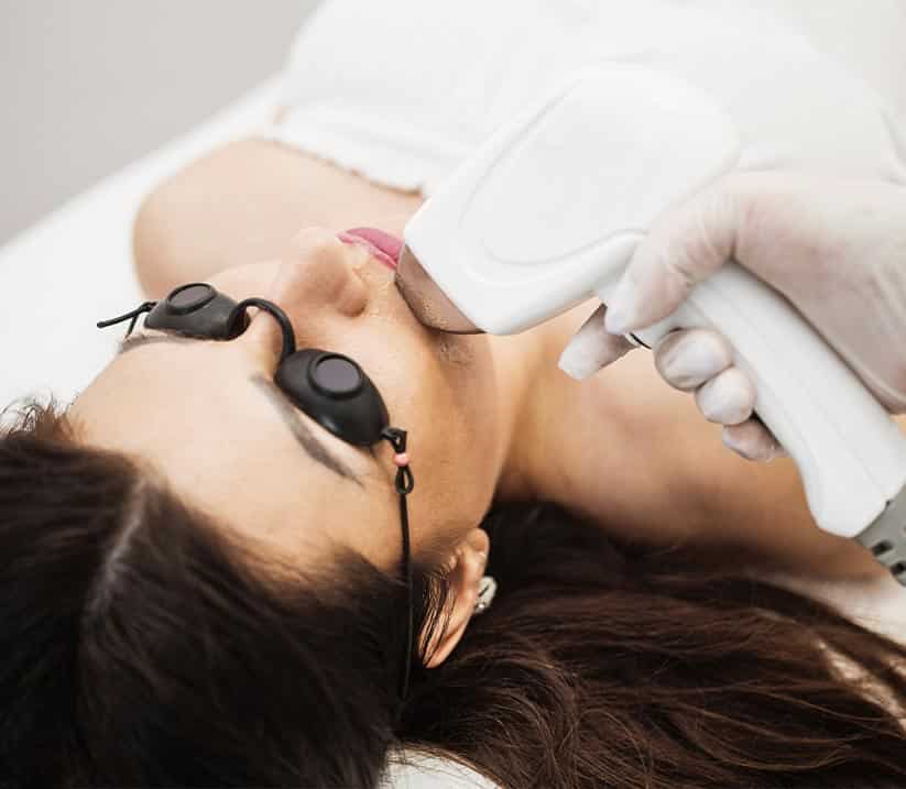 Laser hair removal